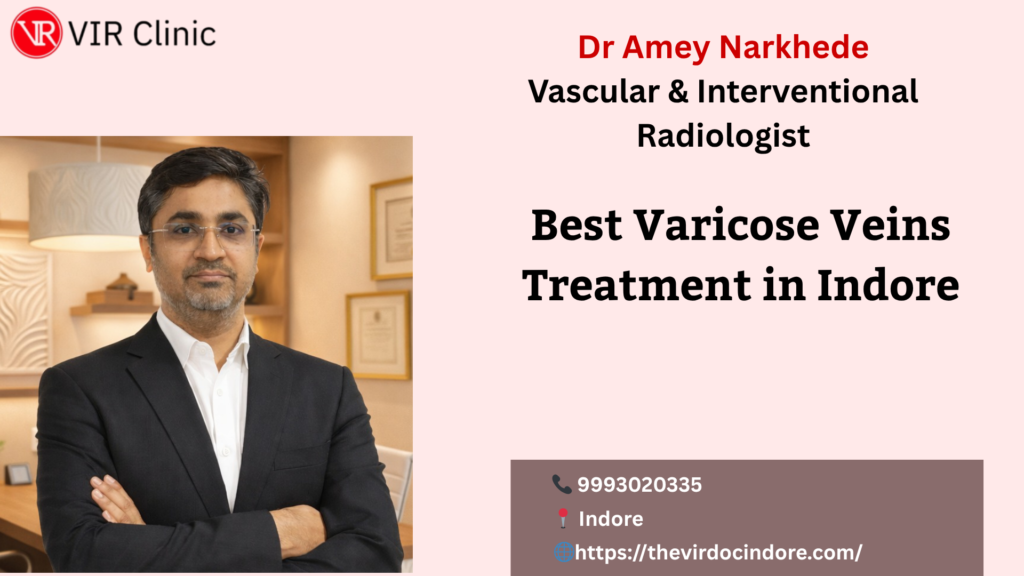 Best Varicose Veins Treatment in Indore