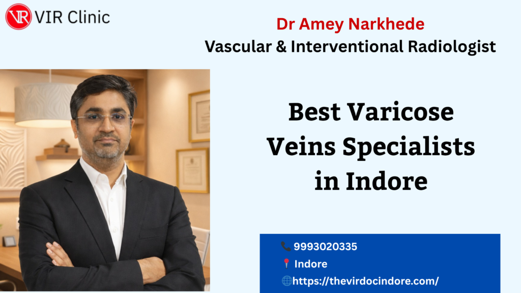 Best Varicose Veins Specialists in Indore