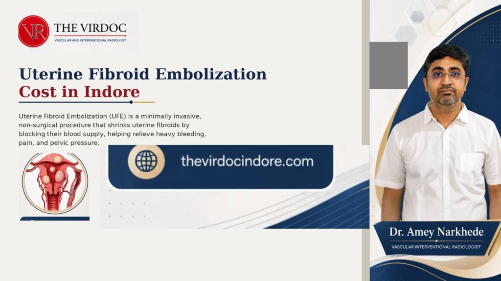 Uterine Fibroid Embolization Cost in Indore Uterine Fibroid Embolization Cost in Indore