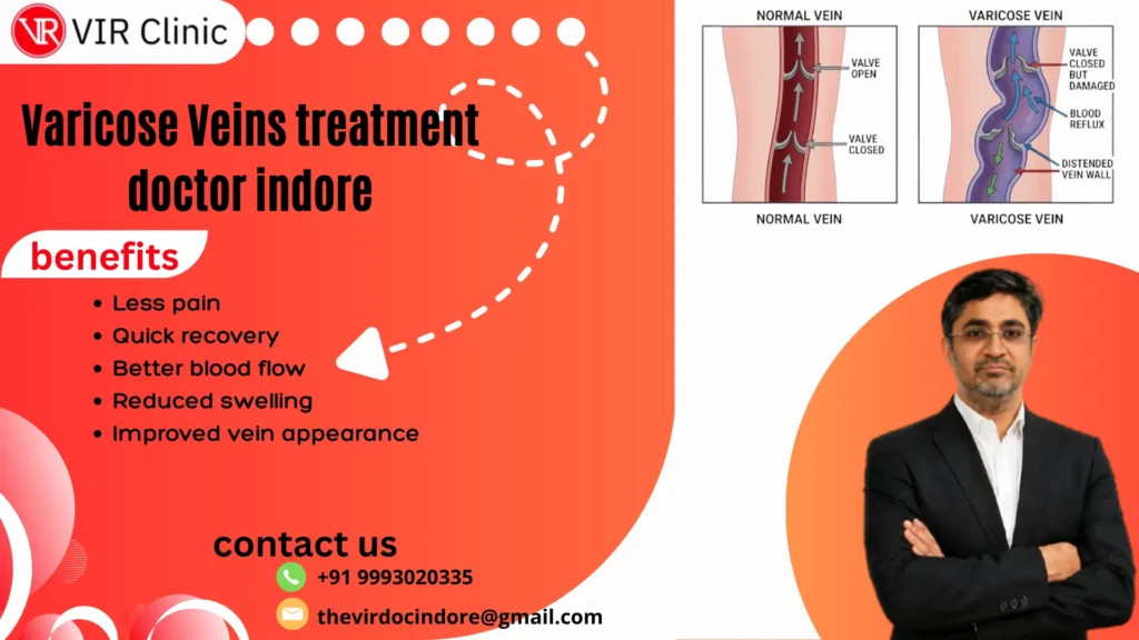 Varicose Veins Doctors in Indore