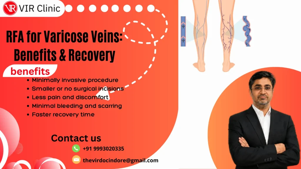 RFA for Varicose Veins: Benefits & Recovery