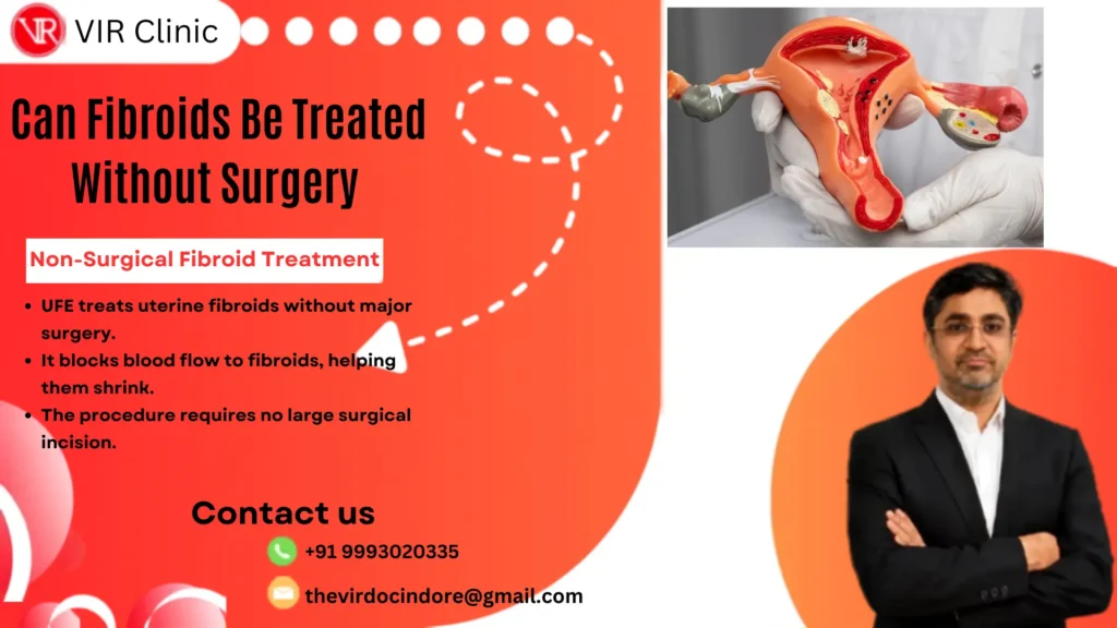 Fibroid Treatment Without Surgery: UFE