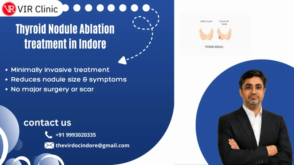 Thyroid Nodule Ablation treatment in Indore